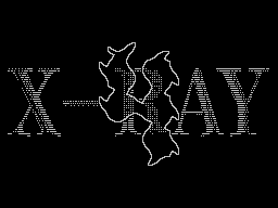 X-Ray